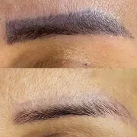 ریموو تخصصی تاتو ابرو