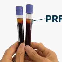 تخفیفات ویژه پی آر اف(PRF) پی ار پی