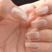 کاشت و ترمیم ناخن