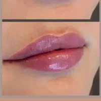 جشنواره ژل و بوتاکس و فیلر بادی و لیفت صورت