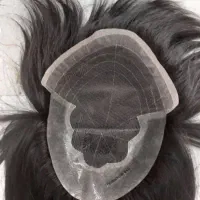 انستیتو ترمیم مو (مرکز موی ایران) پروتز مو