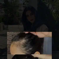 ایا از ریزش مو سر ریش خسته شدی