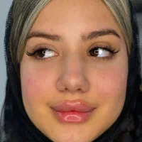 فیلر و بوتاکس