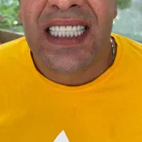 دندانسازی یارمحمدی