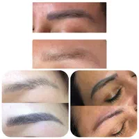 لیزر‌موزائد،ژل بوتاکس مزو،ریمو تتو،هایفو فیشال|خدمات آرایشگری و زیبایی|تهران, جیحون|دیوار