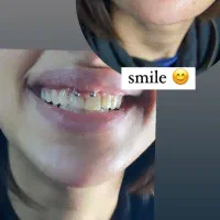 آموزش و اجرای پرسینگ|خدمات آرایشگری و زیبایی|نیشابور, ناسیونال|دیوار