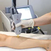 اپراتور لیزر خانم