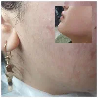 انواع خدمات زیبائی