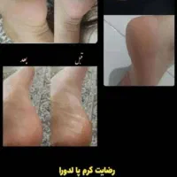محصولات پوست و مو و مشاوره تخصصی پوست و مو|آرایشی، بهداشتی، درمانی|کرج, شهرک فهمیده|دیوار