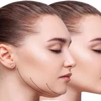 کلینیک زیباییH