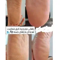 تخفیف لیزرکل بدن فقط۴۵۰ بمناسبت روزمادر تست رایگان|خدمات آرایشگری و زیبایی|زنجان, |دیوار