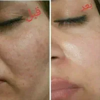 کرم معجزه آسا شب|آرایشی، بهداشتی، درمانی|ساری, |دیوار