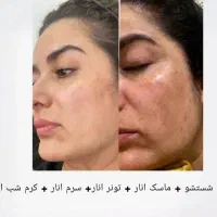 محصولات برند لدورا با مشاوره رایگان|آرایشی، بهداشتی، درمانی|مرودشت, ثبت احوال|دیوار