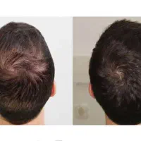 دلت یه تغییر اساسی نمیخاد