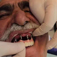 دندانپزشکی زیبا ایمپلنت ۸،۵۰۰ صادقیه غرب تهران|خدمات آرایشگری و زیبایی|تهران, فردوس|دیوار