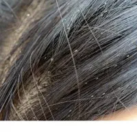 داروی صدرصد گیاهی رشکو و شپش|آرایشی، بهداشتی، درمانی|الوند, |دیوار