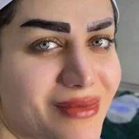 کاشت ابرو  توسط کادر مجرب از تهران