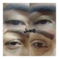 پلکسر پلاسما خالبرداری مزونیدلینگ مزو آموزش|خدمات آرایشگری و زیبایی|زاهدان, |دیوار