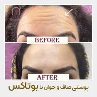 زیبایی ارایشی