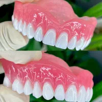 دندان مصنوعی