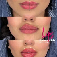 آف فیلر بادی سینه باسن بیکینی دست لاغری شکم Drزنان|خدمات آرایشگری و زیبایی|مشهد, هفت تیر (حافظ)|دیوار