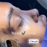 عمل بینی فقط« ۲۹ »میلیون روز ۸  و ۹ اذر|خدمات آرایشگری و زیبایی|تهران, پاسداران|دیوار