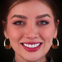 دندانپزشکی تخصصی کامپوزیت ، لمینت ، ایمپلنت اقساطی