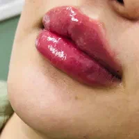 جشنواره ویژه کاشت ابرو ،بوتاکس، فیلر ..|خدمات آرایشگری و زیبایی|بوشهر, |دیوار