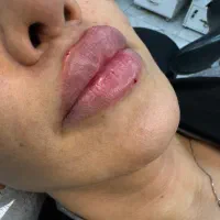 مطب پوست ولیزر دکتر راستگو|خدمات آرایشگری و زیبایی|تهران, مهرآباد|دیوار