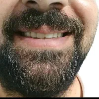 دندانسازی متحرک(شرایط خوب)|خدمات آرایشگری و زیبایی|قیدار, |دیوار