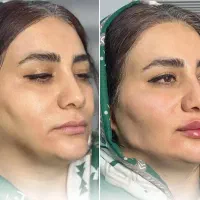 تخفیفات یلدایی ،مدل رایگان ،کلینیک دارای ۳شعبه|خدمات آرایشگری و زیبایی|شهریار, شهرک بهاران (ویره)|دیوار