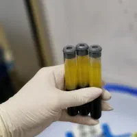 آموزش پی آرپی،پی آر اف،اگزوزوم،مزوتراپی،بایوفیلر