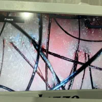 پاکسازی سر و صورت