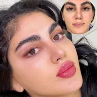 تزریق چربی، ژل وبوتاکس ومادلینگ صورت توسط پزشک|خدمات آرایشگری و زیبایی|کرمانشاه, |دیوار