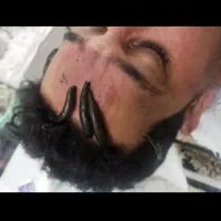 طب سنتی زالو درمانی و حجامت|خدمات آرایشگری و زیبایی|اهواز, گلستان|دیوار