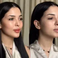 کلینیک پوست زعفرانیه نسل جدید بوتاکس گازی نخ فیلر|خدمات آرایشگری و زیبایی|تهران, زعفرانیه|دیوار