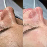 فیشیال و اکستنشن مژه و پدیکور