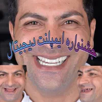 جشنواره ایمپلنت دیجیتال/کاشت دندان/دندانپزشکی