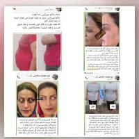 لاغری آسان و پوست زیبا رو با ما تجربه کن