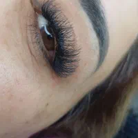 آفر ویژه اکستیشن کاشت و لیفت