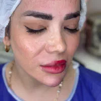 کاشت ابروتاربه تار/طبیعی/اقساطی|خدمات زیبایی و سلامت|تهران, صادقیه|دیوار