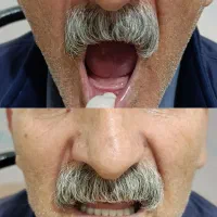 دندان مصنوعی|خدمات آرایشگری و زیبایی|آبیک, |دیوار