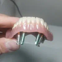 لابراتوار دندانسازی تخصصی متحرک و ثابت ایران مهر