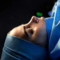 عمل بینی در اهواز|خدمات آرایشگری و زیبایی|اندیکا, |دیوار