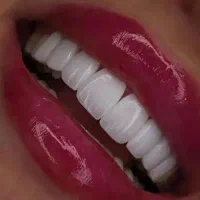 کامپوزیت دندان با چک . اقساط دندانپزشکی . تخفیفات|خدمات آرایشگری و زیبایی|تهران, صادقیه|دیوار