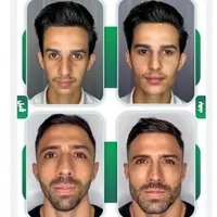 مدل تعداد محدود جهت تزریق لب روسی و کانتورینگ صورت|خدمات آرایشگری و زیبایی|تهران, زعفرانیه|دیوار