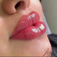 جشنواره تزریق تخصصی ژل و بوتاکس کلینیک نورا|خدمات آرایشگری و زیبایی|کرمانشاه, |دیوار