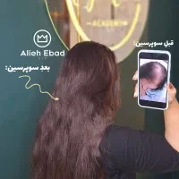 رشد ۴برابری مو سر ابرو تک جلسه گارا نتی یلدا