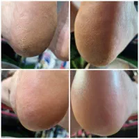 پاکسازی فشیال تخصصی vipصورت .پدیکور پا