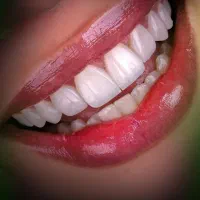 کامپوزیت، لمینت، ایمپلنت اقساط ویژه|خدمات آرایشگری و زیبایی|میبد, |دیوار